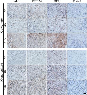 Development of Biomimetic Hepatic Lobule-Like Constructs on Silk-Collagen Composite Scaffolds for Liver Tissue Engineering